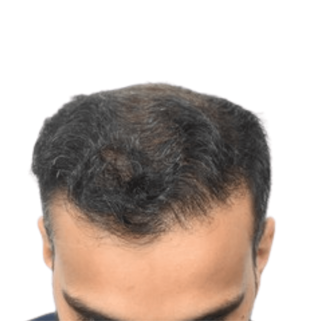 After Patient 13 v2