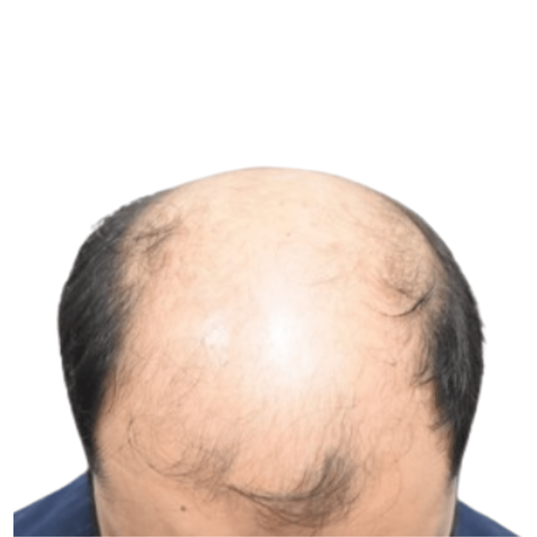 Before Patient 15 v3