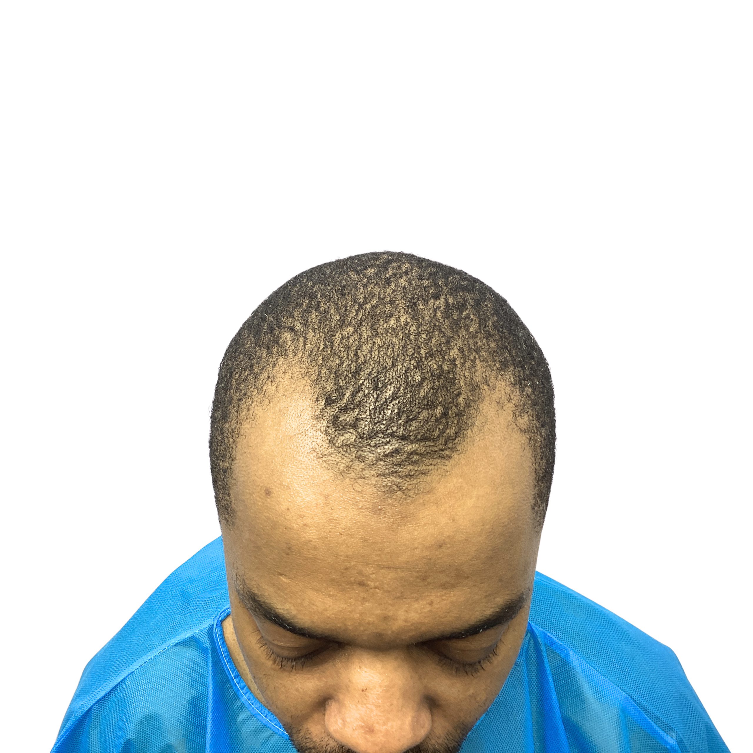 Afro 1 Before