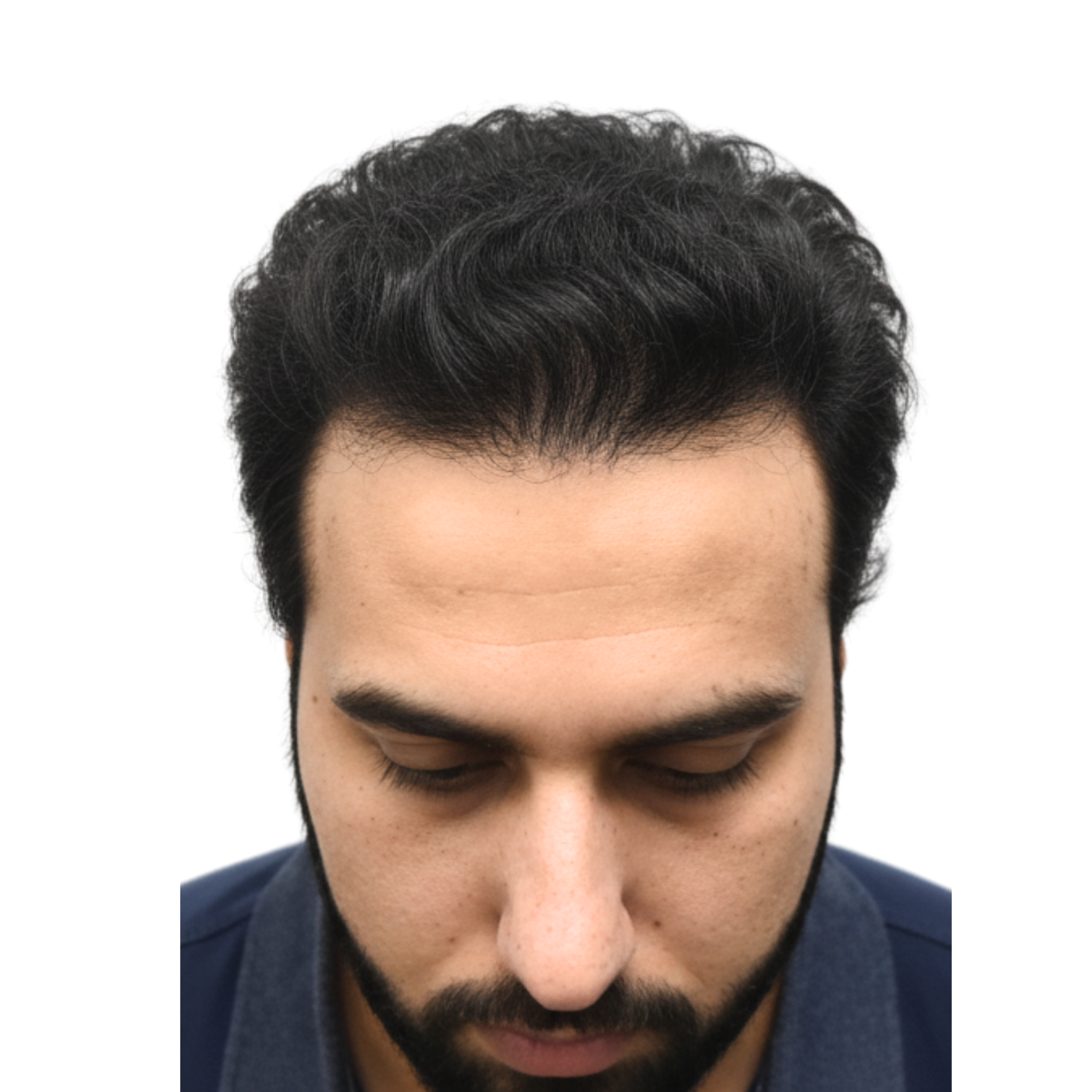 Ahmed after