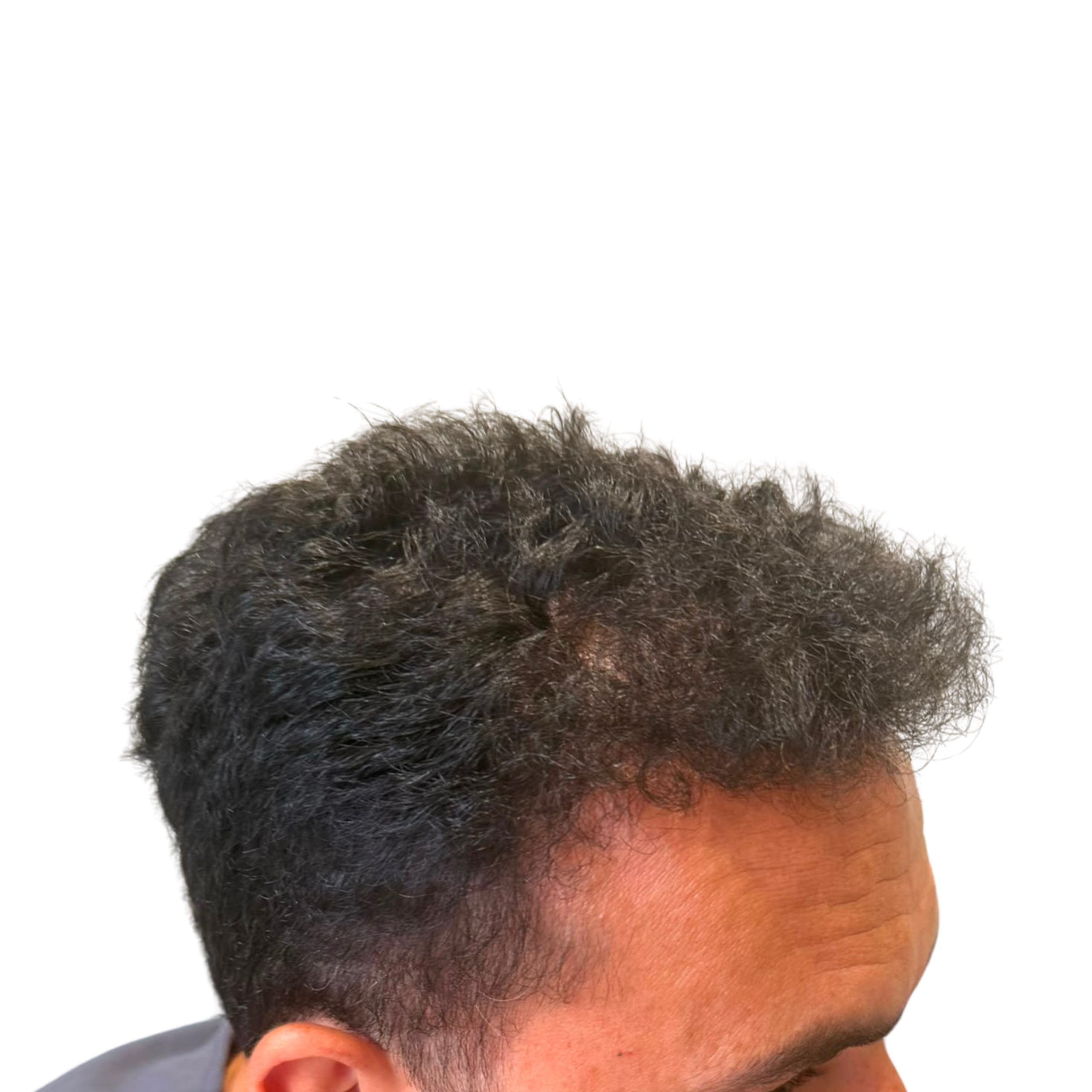 Ali After