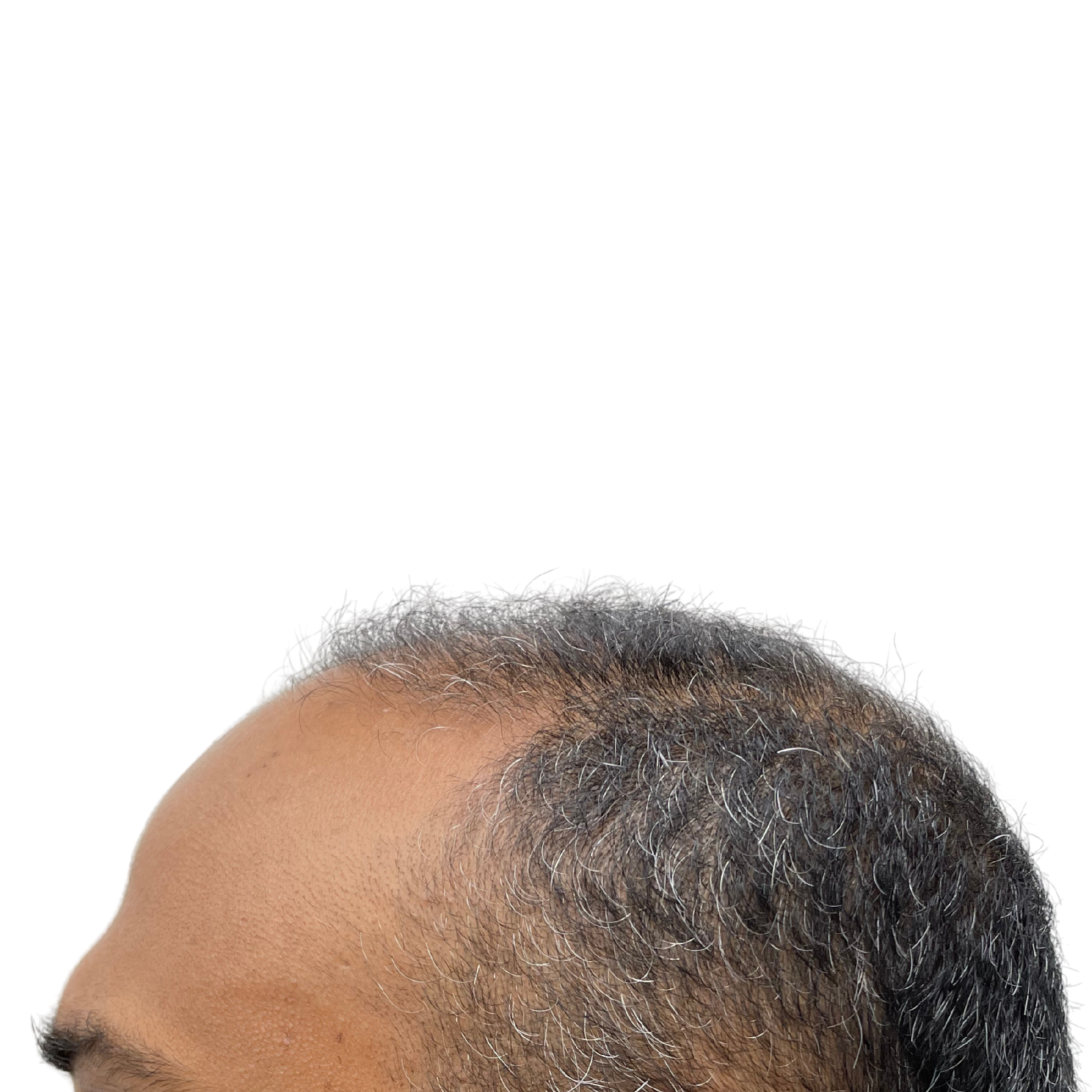 Amit Before