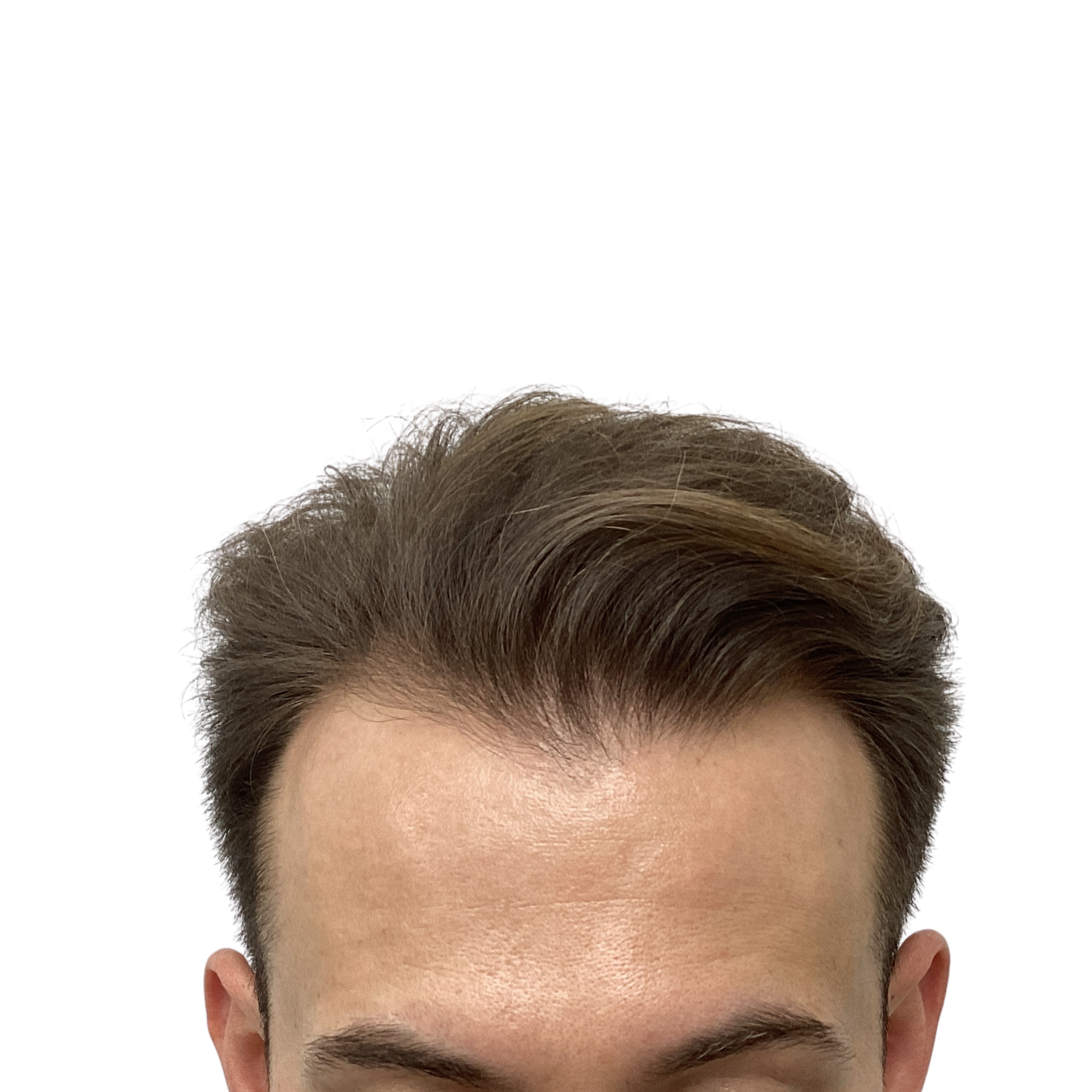 Artur before