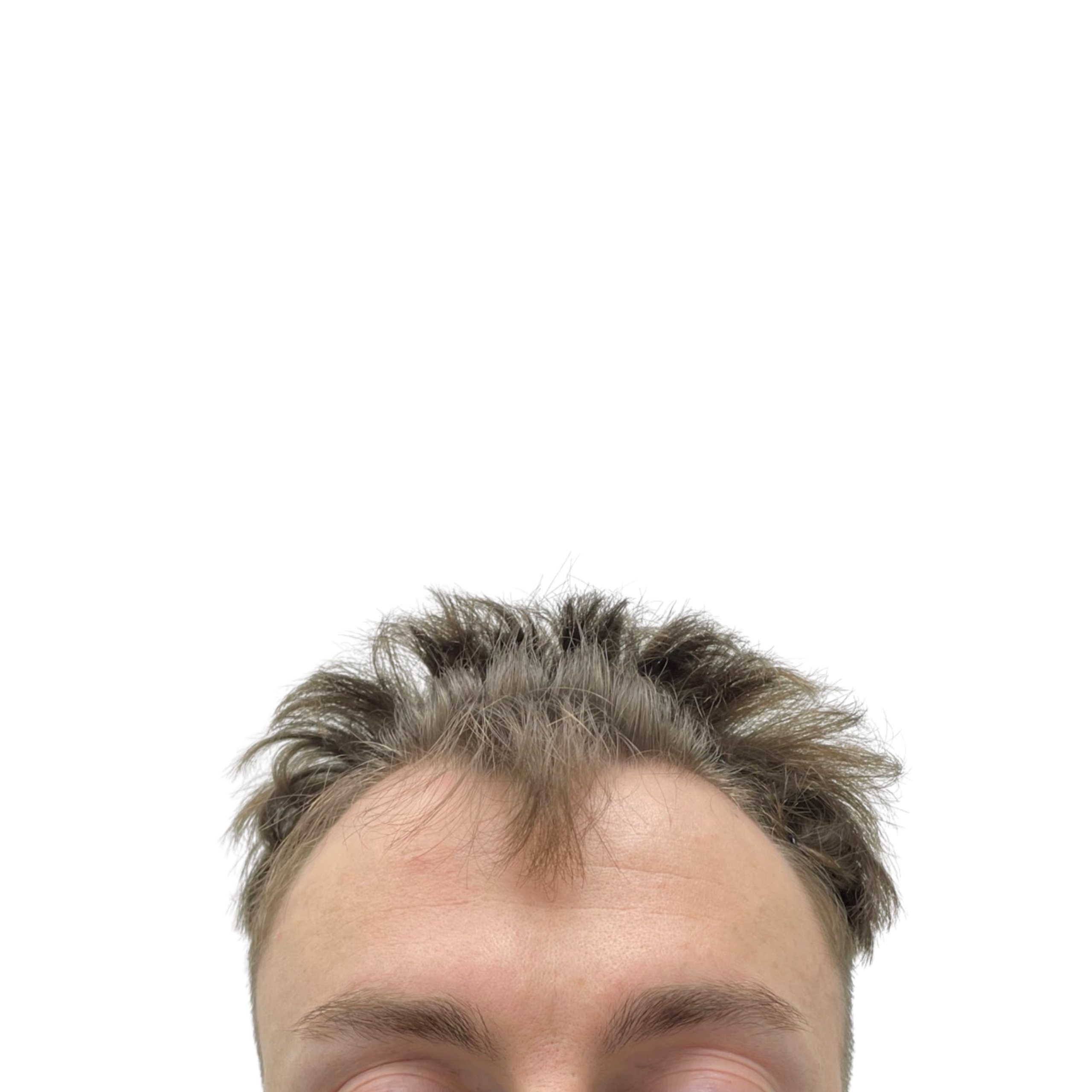 Chris before