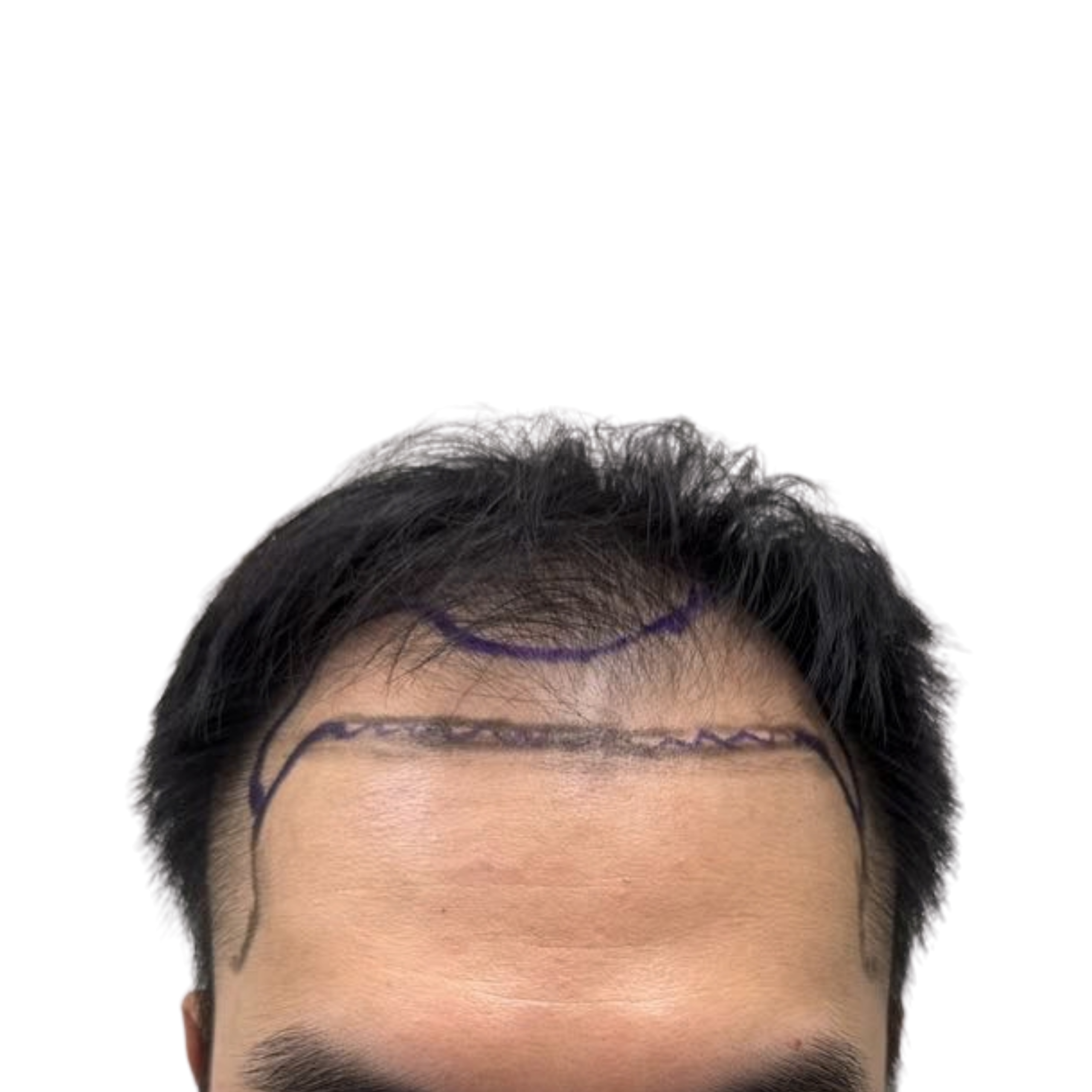 Viet before
